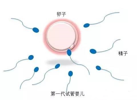 试管代怀包生捐卵公司
